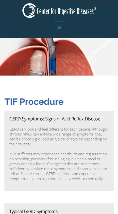 CDD TIF Procedure Mobile